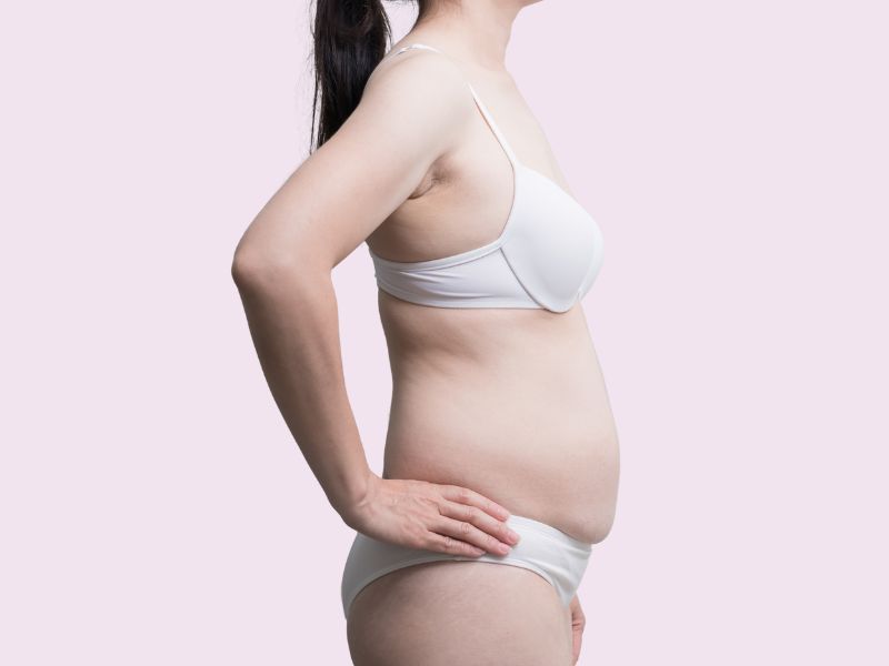 bono pad abdominoplastia fonasa