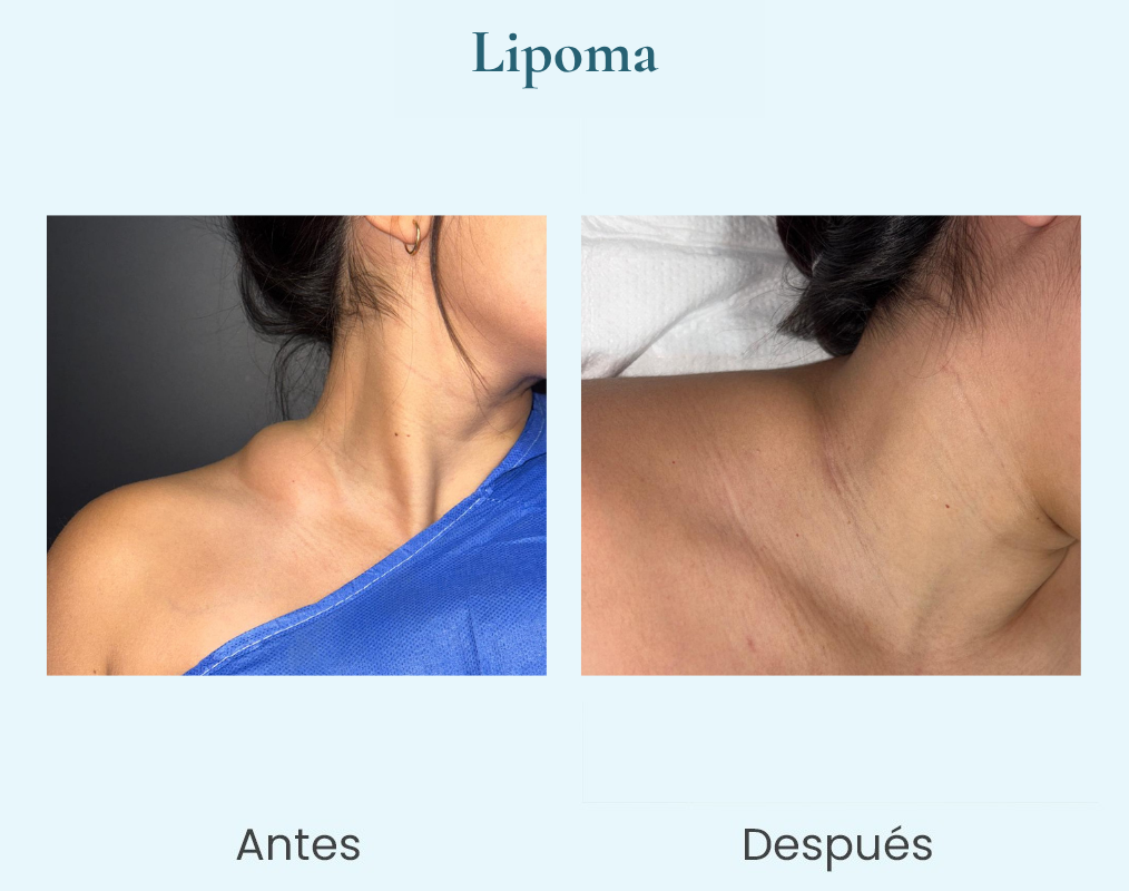 antes y despues (3)
