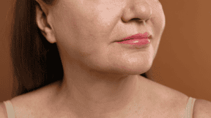 linfting facial vs faceite