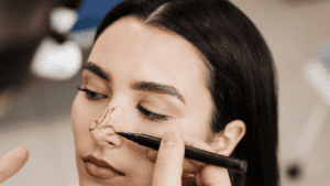 rinoplastia mejor cirujano