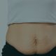 bono pad fonsa abdominoplastia