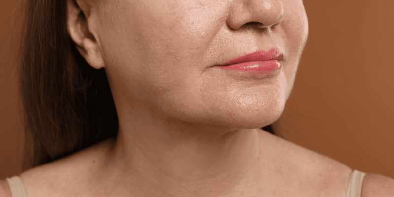 linfting facial vs faceite