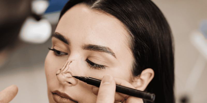 rinoplastia mejor cirujano